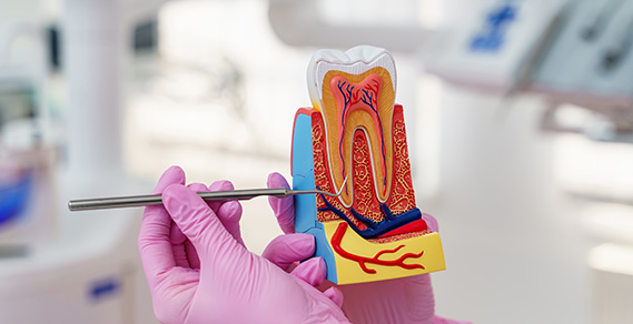 Root Canal Treatment Cost in Faridabad 