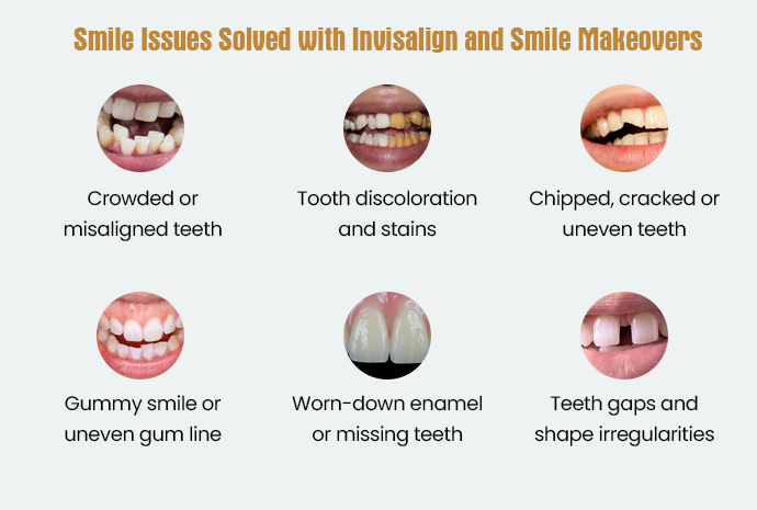 achieve a perfect smile with invisalign and smile makeover