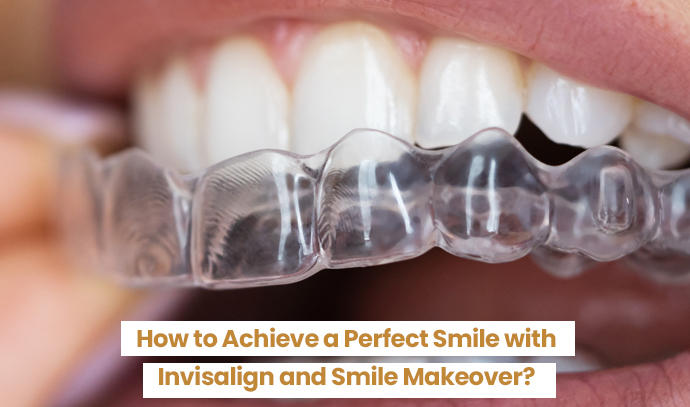 How to Achieve a Perfect Smile with Invisalign and Smile Makeover?