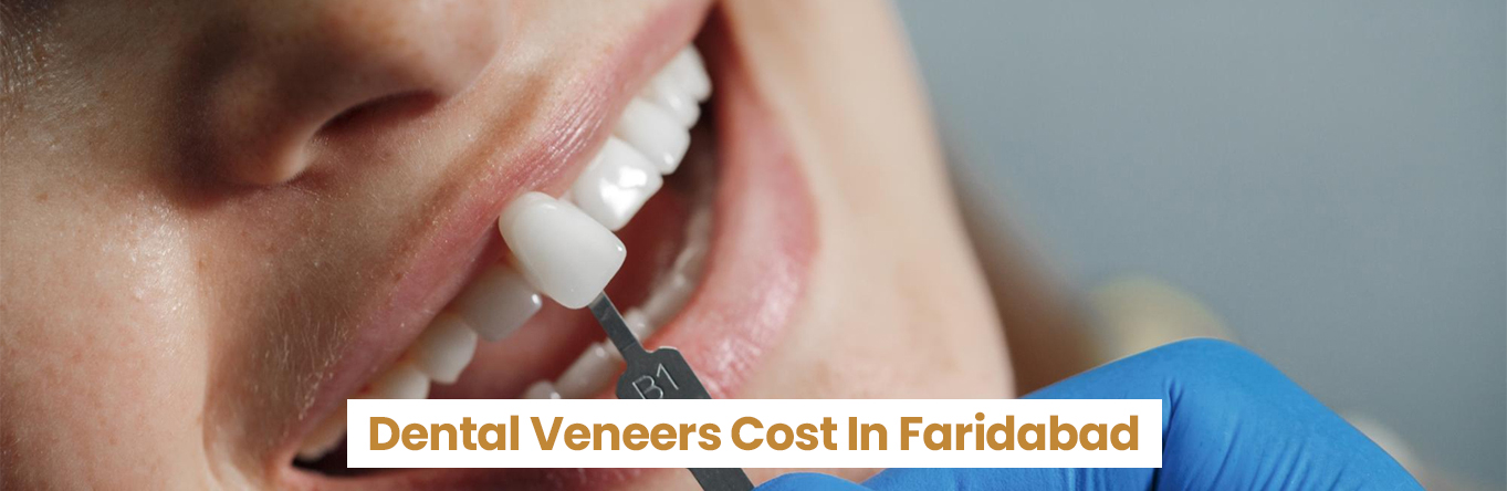 Dental Veneers Cost In Faridabad