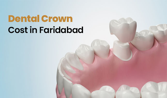 Dental Crown Cost in Faridabad