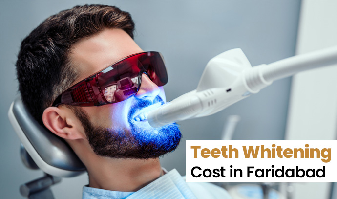 Teeth Whitening Cost in Faridabad