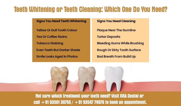 teeth whitening cost in faridabad