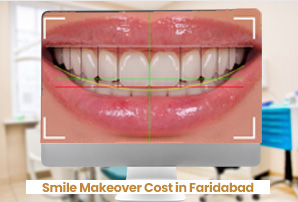 Smile Makeover Cost in Faridabad