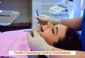 Teeth Cleaning Cost in Faridabad