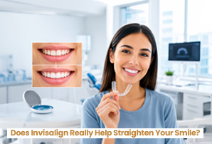 Does Invisalign Really Help Straighten Your Smile?