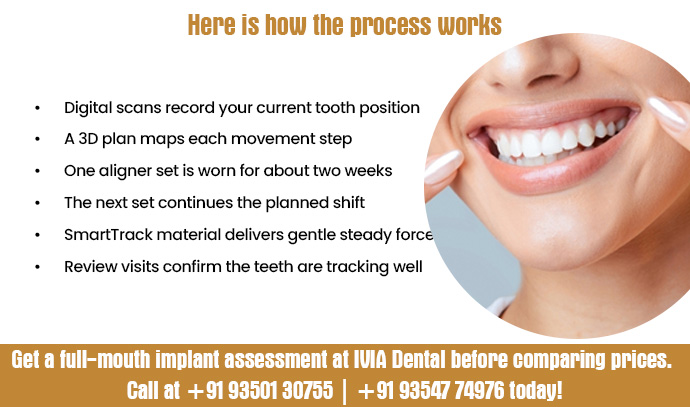 invisalign really help straighten your smile