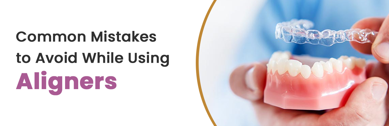 Common Mistakes to Avoid While Using Aligners