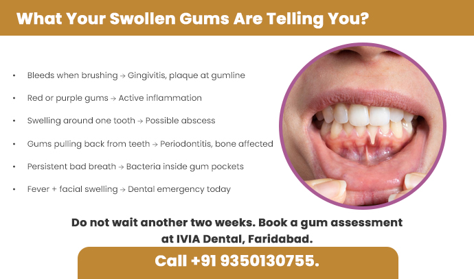 what your swollen gums are telling you