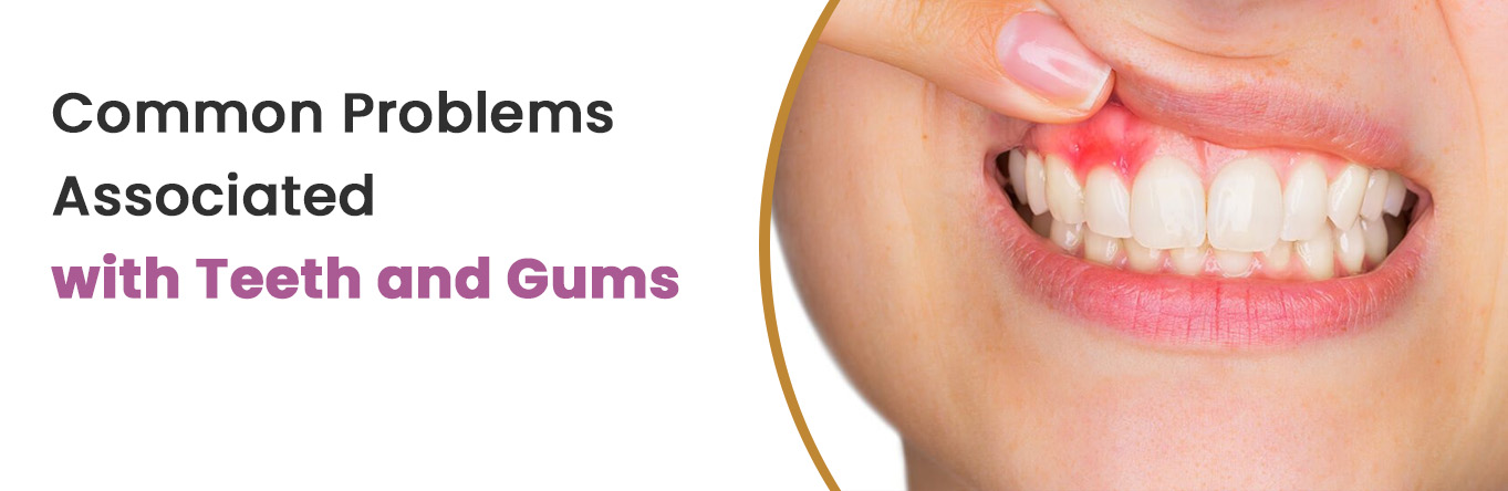 Common Problems Associated with Teeth and Gums