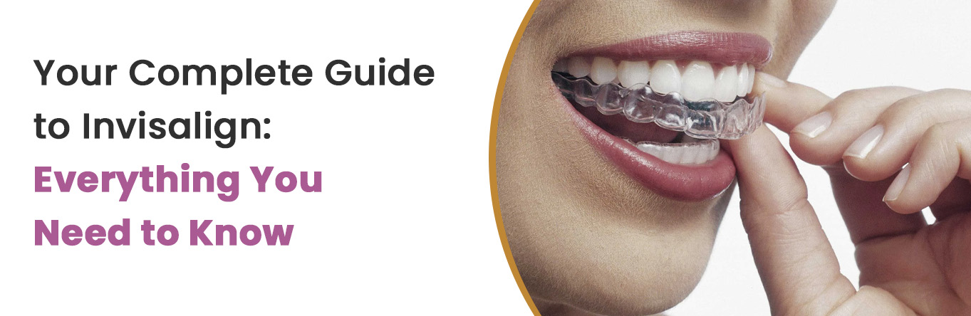 Your Complete Guide to Invisalign: Everything You Need to Know