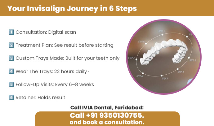 your invisalign journey in 6 steps
