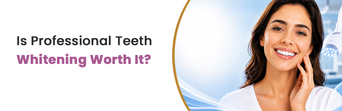 is professional teeth whitening worth it