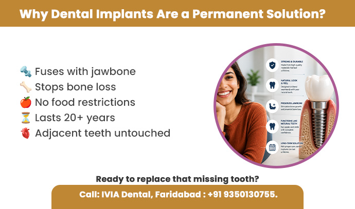why dental implants are a permanent solution