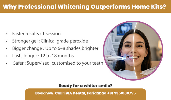 why professional whitening outperforms home kits